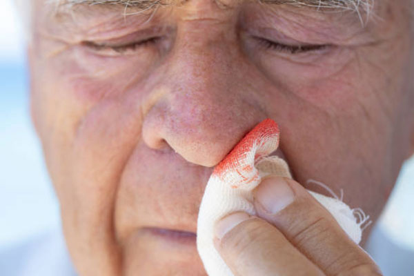 عوارض شایع دارو رقیق کننده خون